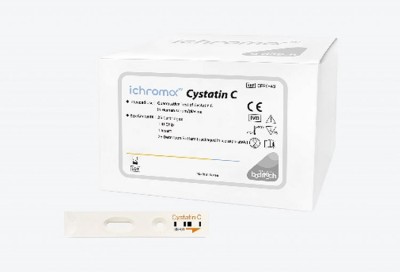 Cystatin C test