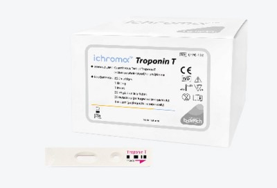 Troponin T(Tn-T) test