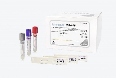 IGRA-TB test