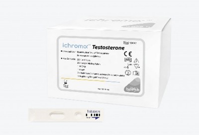 Testosteron test